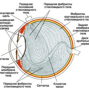 Диагностика и лечение гемофтальма